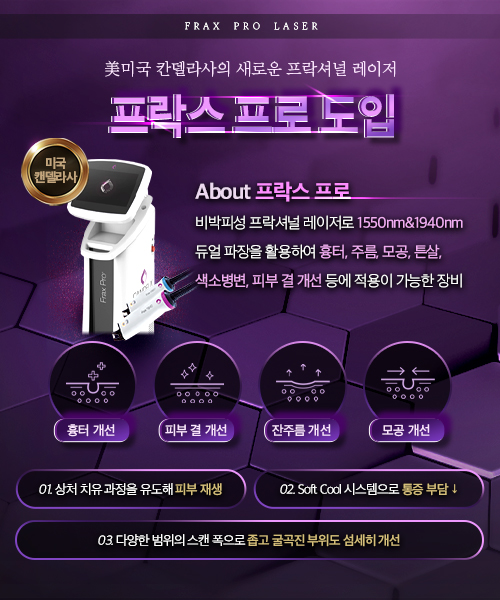프락스 프로 도입