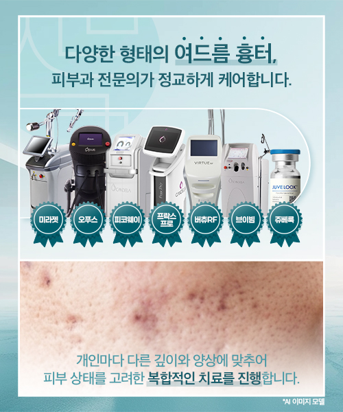 여드름흉터
