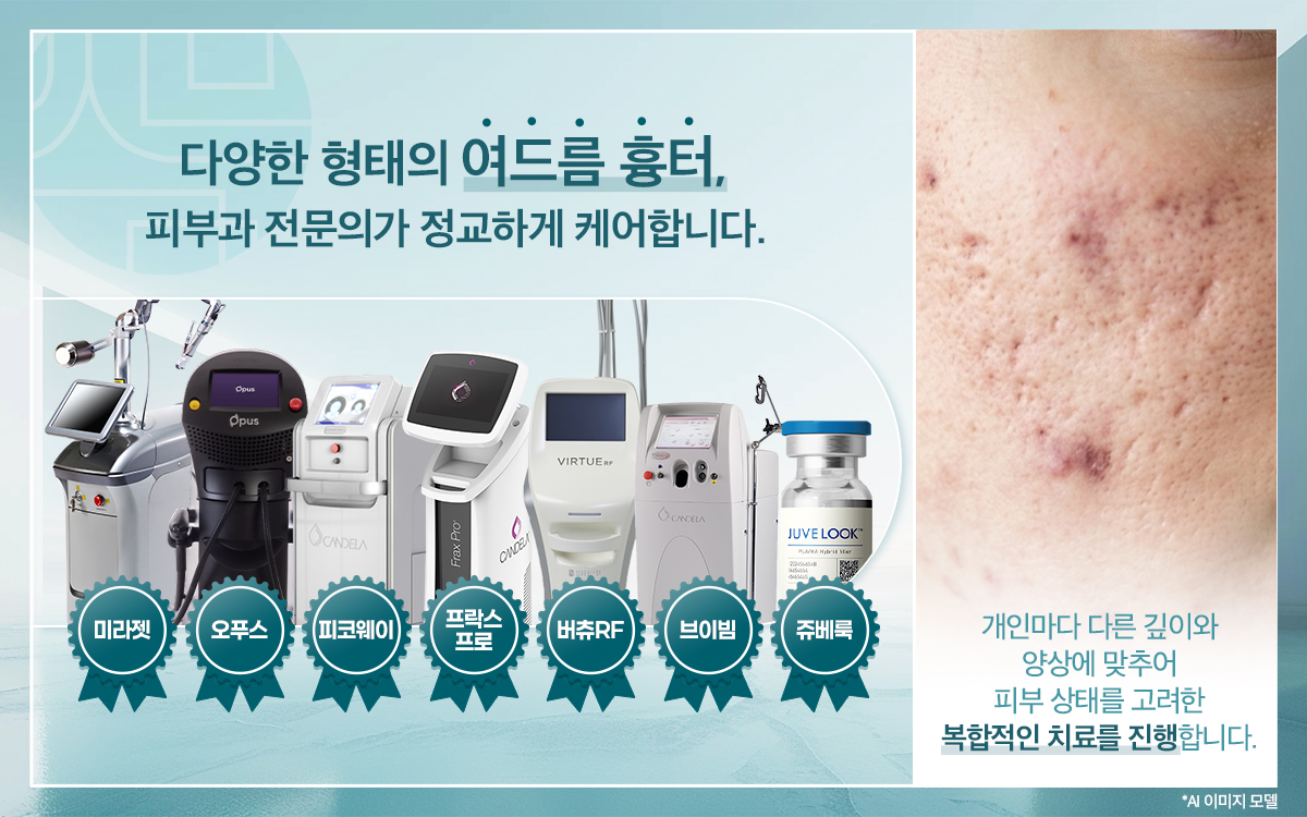 여드름흉터
